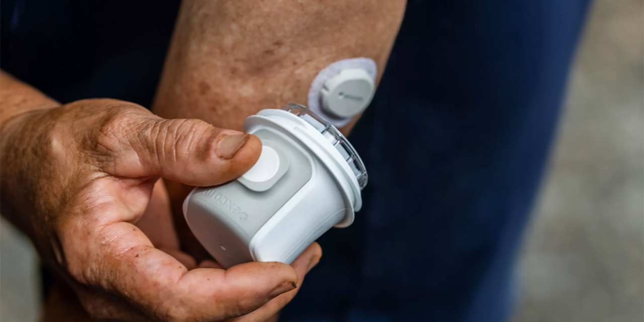 Dexcom G7 CGM: Real-Time Glucose Monitoring Simplified