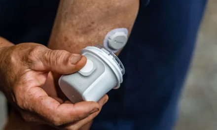 Dexcom G7 CGM: Real-Time Glucose Monitoring Simplified